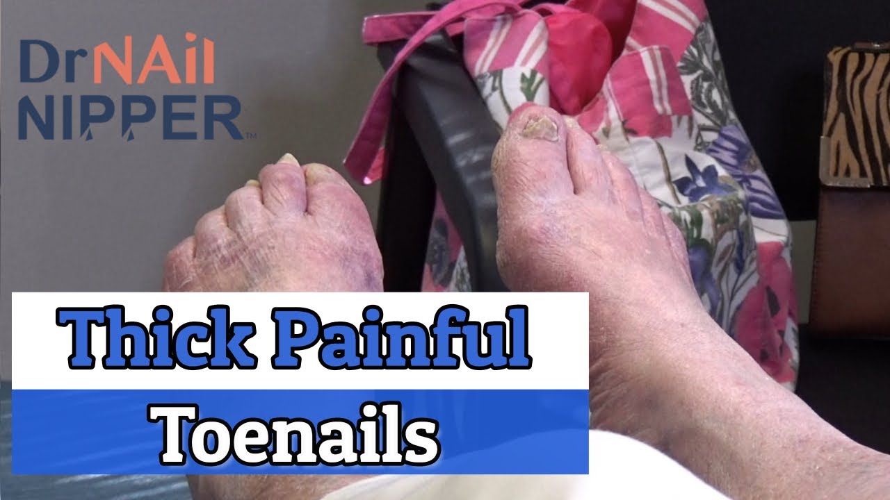 Lawn Mowing Grandma's Thick Painful Toenails (2020) 3