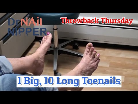 One Big Toe, 10 Long Toenails [Throwback Thursday] 1
