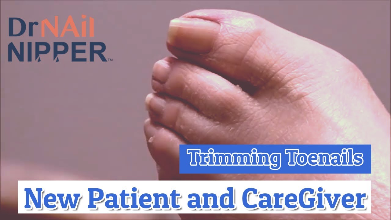 New Patient and Care Giver Receives Trimming Toenails [Throwback Thursday] 5