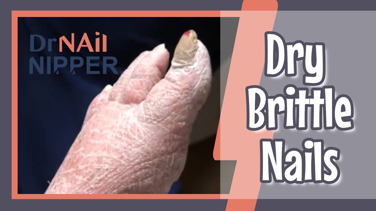 Have you seen toenails like this before? [Throwback Thursday] 5