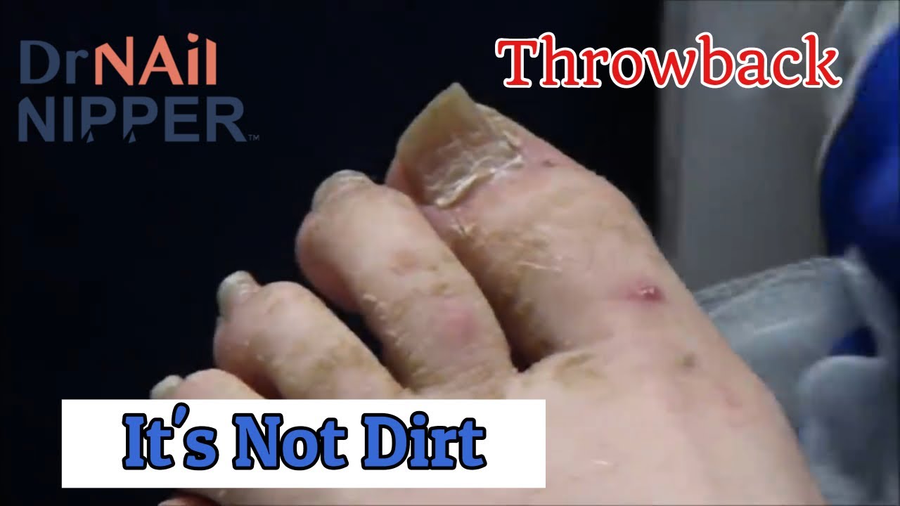 Moisturizing Feet Is Good: "It's Not Dirt" [Throwback Thursday] 1