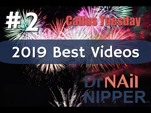 #2 Best Video of 2019, Dr Nail Nipper [Callus Tuesday] 1