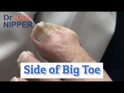 Have You Seen this Big Toe? with a Nice Patient [Bonus] 1