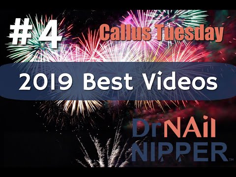 Best Videos of 2019 - #4 [Callus Tuesday] 1