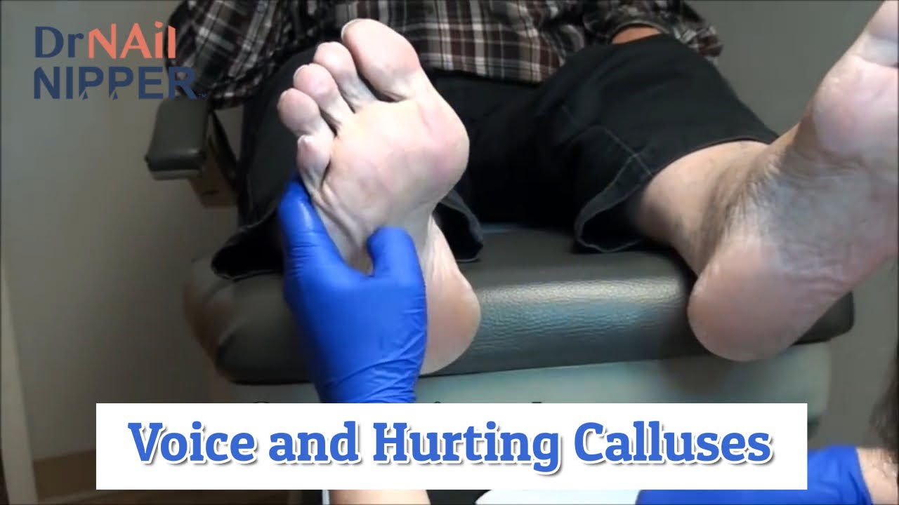 Deep Voice and Hurting Calluses [Throwback on a Wednesday] 1