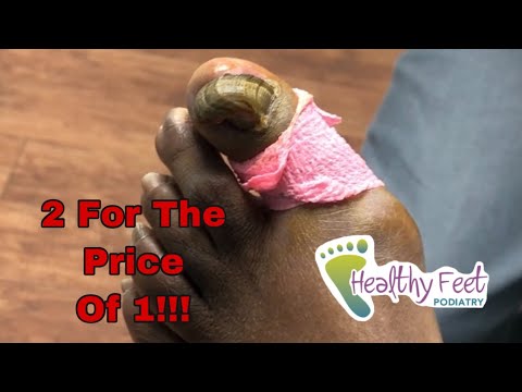 RAM'S HORN AND SQUIRTING NAIL!!!!! 1