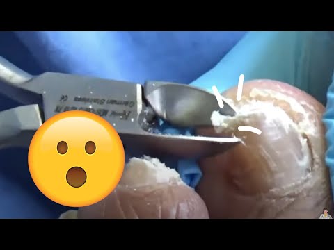 Russian Lady with Serious Nail Trim! 1
