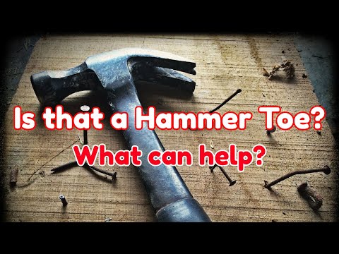 How to use a Budin Splint for Hammer Toe - Dr Nail Nipper (2020) 1