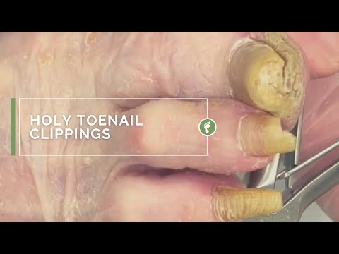 HOLY TOENAIL CLIPPINGS 1
