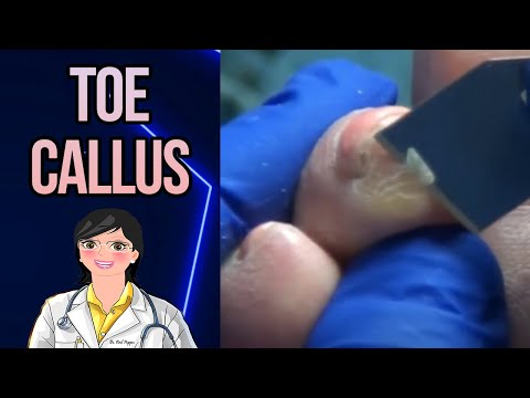 Lots of Calluses - And Music 1