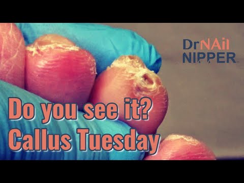 Two Gentlemen of Toerona. Do you know it? [Callus Tuesday] (2021) 1