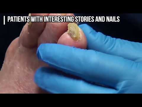 Dr. Nail Nipper Fan Page - Best Nails on Planet YouTube 1 Dr. Nail Nipper Fan Page - Best Nails on Planet YouTube 1