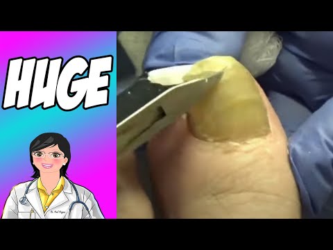 Huge Nails! How Do They Fit in Shoes? 1