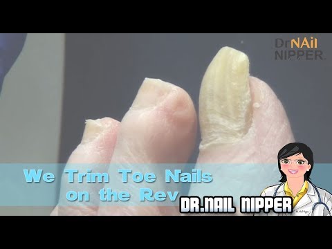 We Trim Toe Nails on "The Rev". Is Trimming Toenails Feel Good? 1