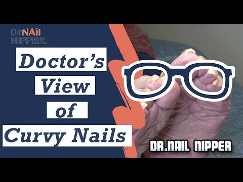 Dr Nail Nipper's View of Curvy Nails 1