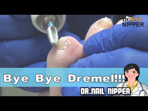 Bye Bye Dremel!!!! 1