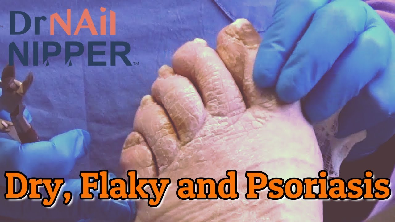 Feature Friday (2021) 1