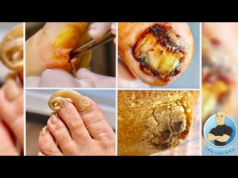 CAN YOU HANDLE THE TOE BRO?! ***1M SUBSCRIBER VIDEO CHALLENGE*** 1