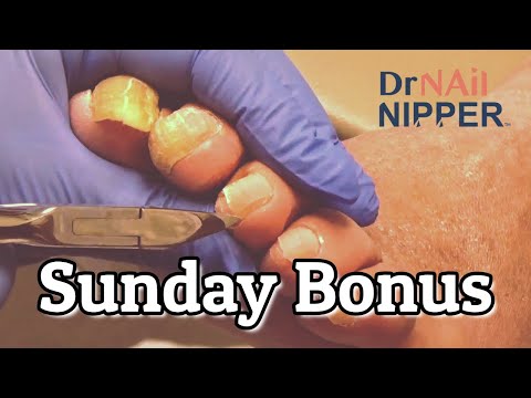 Sunday Bonus - NOT The 1989 Movie "My Left Foot" (2021) 1