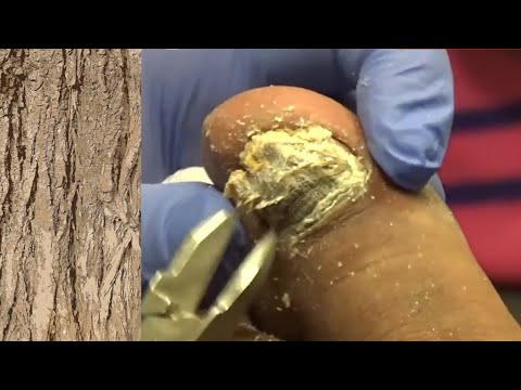 Amazing "Bark" Nails - And Music 1