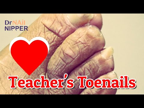 Intro for Series - Teachers Toenails [April 16] (2021) 1