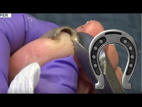 Horseshoe Nails and Music 1