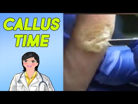 Nails, Calluses, Tunes! Trim Them Down! 1