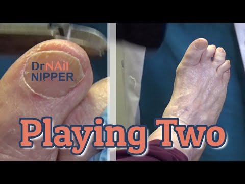 FEET-ure Friday (2021) 1