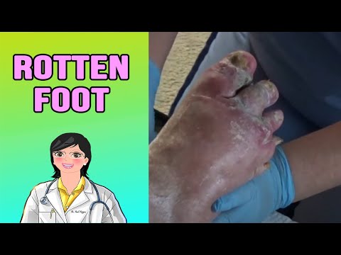 Joanne's Rotten Nail Housecall 1