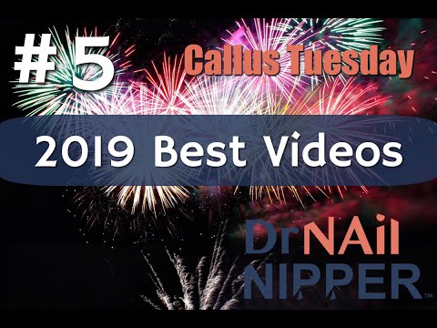 Best of 2019 - #5 [Callus Tuesday] 1