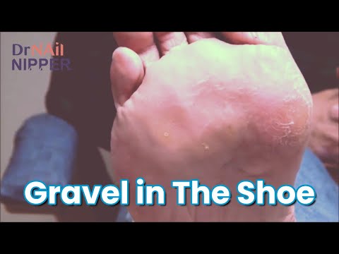 Walking in Gravel Shoes [Throwback Thursday] 1