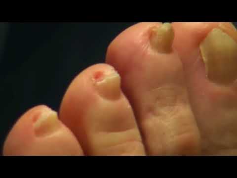 Painful Nails - Dr Nail Nipper's Early Work - Music Only 1