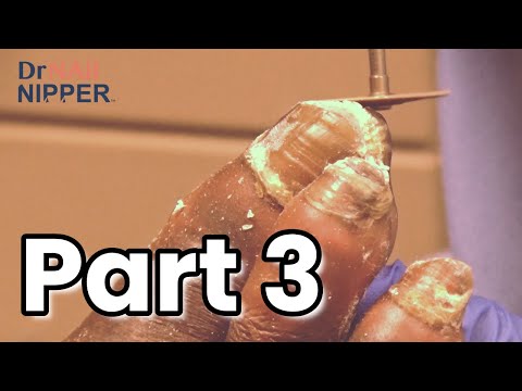 Friday FEET-ure (2021) 1