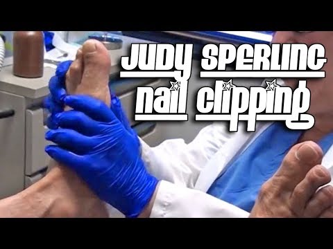 Oddly Satisfying Nail Care - Dr. Nail Nipper's Summer of Nails 1 Oddly Satisfying Nail Care - Dr. Nail Nipper's Summer of Nails 1
