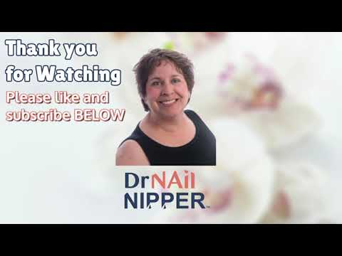 Me estoy quitando una uña enterrada de forma permanente [English Subtitles] (2021) 1