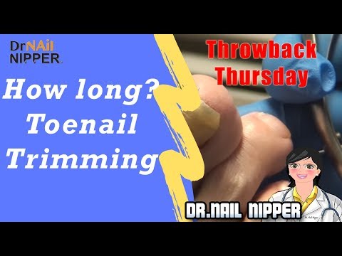 How Long Are Those Toenails? #9 - Throwback Thursday 1