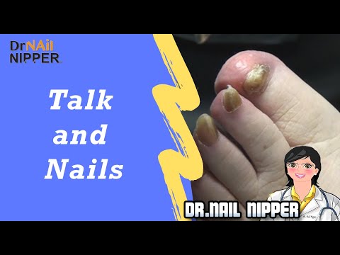 Why cutting toenails feels good? ToeNail Talk [Premiere Friday] (2019) 1