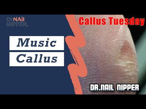 Do you Enjoy Music with a Callus? (2020) 1