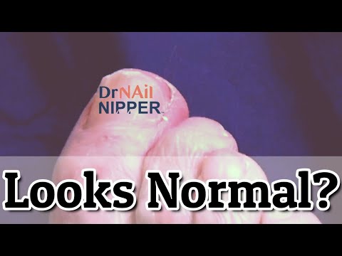 Looks Normal. What is rheumatoid arthritis? (2021) 1 Looks Normal. What is rheumatoid arthritis? (2021) 1