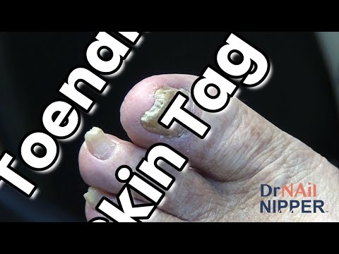 FEET-ure Friday (2021) 1