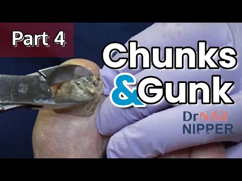 #4 Chunks and Gunk (2021) 1