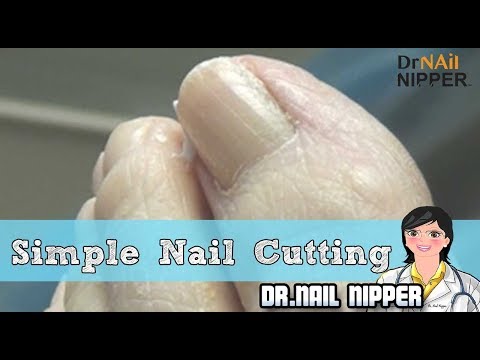 Simple Nail Cutting with Mr G 1 Simple Nail Cutting with Mr G 1