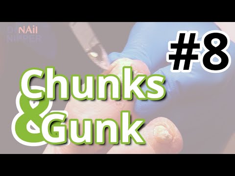 Chunks and Gunk #8 with Music (2021) 1