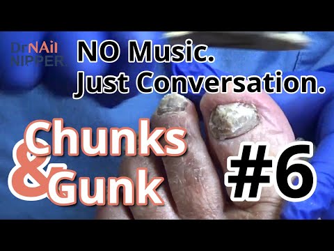 Saturday Bonus: Chunks and Gunk #6 with conversation and No Music (2021) 1
