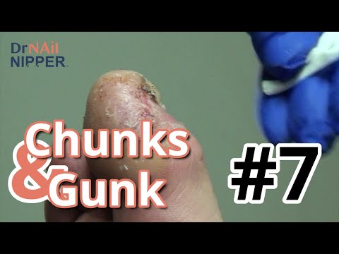 Chunks and Gunk #7 1