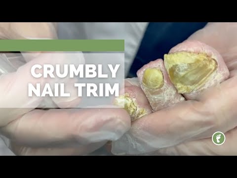 ✌️ for ☝️SPECIAL! 1