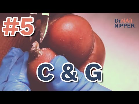 #5 - Everyone Like this? (2021) 1