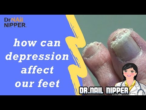 Can depression Affect Your Feet? Discussion on Mental Health and Foot Care 1
