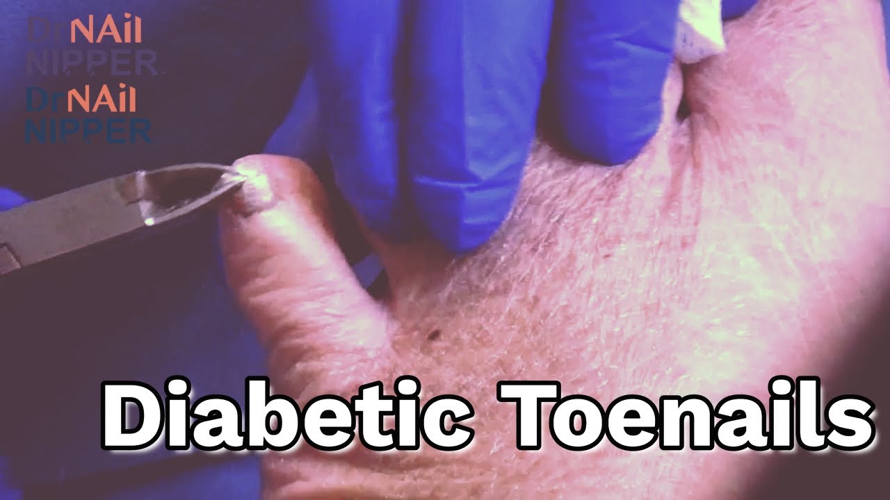 FEET-ure Friday (2021) 1