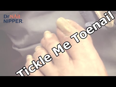 Ticklish for the Patient. On the Foot or the Toes? (2021) [Replay] 1